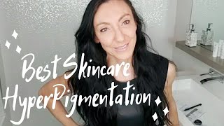 How to Treat Hyperpigmentation | Medical Grade Skincare