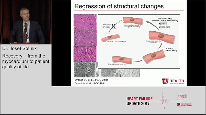 Dr. Josef Stehlik: "Recovery, from the myocardium ...