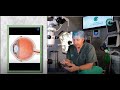 What Is a Vitrectomy? Understanding Retinal Surgery
