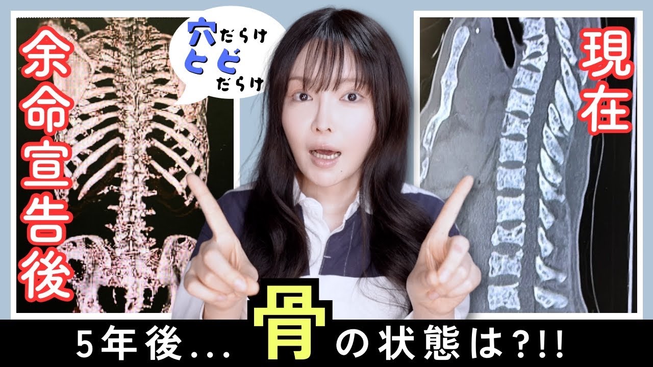 骨 の 癌 余命