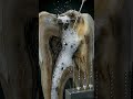 How a Dead Tooth is Saved 🦷 Root Canal Treatment Explained (3D Animation) #dentalcare #teethdecay