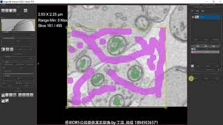 ORS Dragonfly软件2020.1版本中Segmentation Wizard工具的使用方法