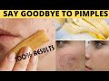 I Rubbed Banana Peel On My Face & My Pimples Are Gone | 100% Results | Banana Face Mask
