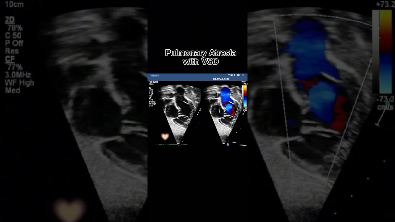 congenital 💞 defects 