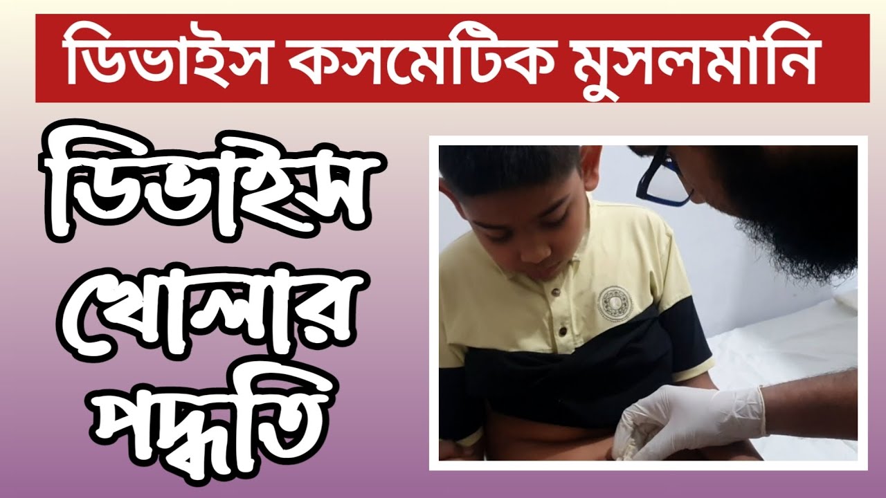 ডিভাইস খোলার দিন। ডিভাইস কসমেটিক খাতনা