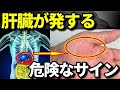 肝機能が低下し肝臓が悲鳴を上げているサイン7選!肝臓疲労で現れる前兆・症状とは?知ってよかった健康雑学