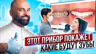 видео: ЛИЦЕВОЙ СКАНЕР покажет твою БУДУЩУЮ УЛЫБКУ всего ЗА 10 МИНУТ. Искусственный Интеллект в стоматологии картинка: ЛИЦЕВОЙ СКАНЕР покажет твою БУДУЩУЮ УЛЫБКУ всего ЗА 10 МИНУТ. Искусственный Интеллект в стоматологии