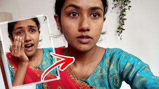 Testing Out *FRESH LOOK ONE DAY LENS WITH MAKE-UP AND WITHOUT MAKE-UP* | Archana M R