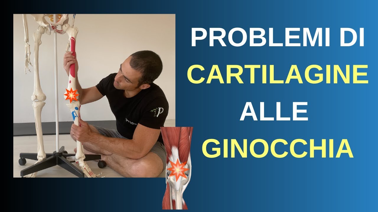 Problemi di CARTILAGINE alle GINOCCHIA ecco cosa fare (guida completa