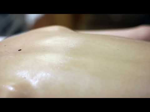 CANDLE MASSAGE