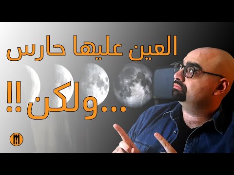العين عليها حارس ولكن