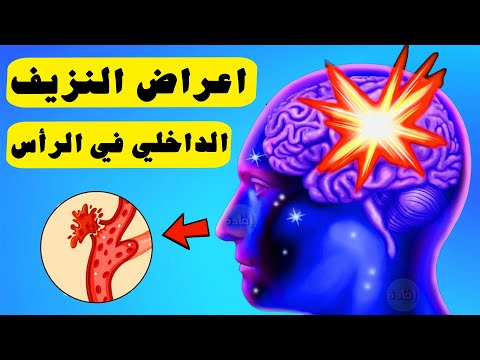 اعراض النزيف الداخلي في الرأس