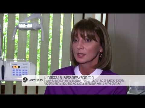 ღრძილის ჭარბი ზრდა