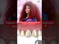 Are Celebrity Teeth natural? #rakhisawant #bollywood #whiteteeth