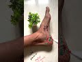 Plantar Fasciitis vs Baxter Nerve Entrapment | Don’t Misdiagnose Heel Pain! #heelpain #nervepain