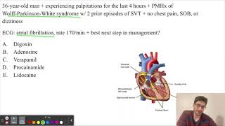 Step 2CK Q6: Wolff Parkinson White syndrome