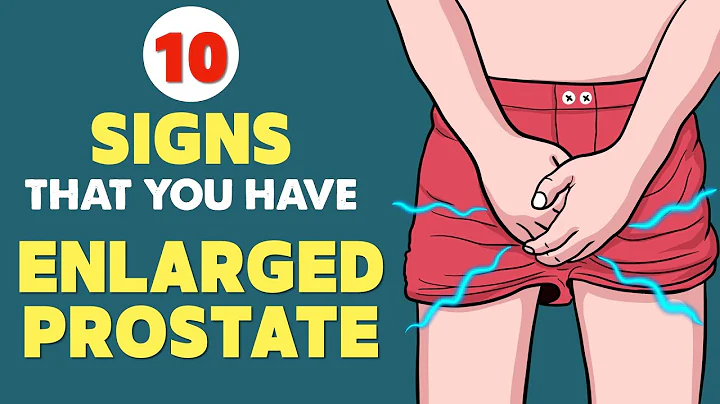 Enlarged Prostate (BPH) - Signs & Symptoms | Every Man Needs to Know This - DayDayNews