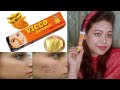 Vicco Turmeric cream pre-bridal treatment acne scars dark spots ke liye bhi use kijiye  #viccocream