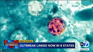 Cyclosporiasis outbreak linked to shredded iceberg lettuce expands to 9 states