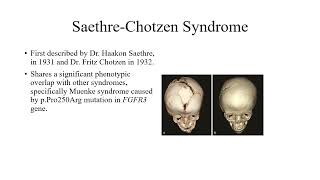 Video 218 1 Molecular Genetics and Principles of Craniosynostosis