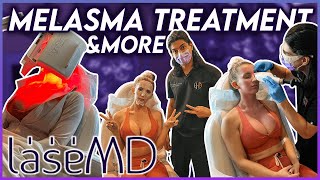 Trying A New Laser For Sun Damage, Melasma, & Rough Skin Texture Zero Downtime