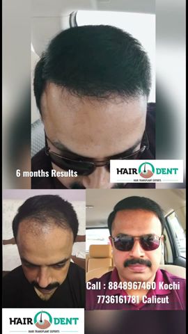 Hair O Dent in KadavantharaErnakulam  Best Hair Transplant Clinics in  Ernakulam  Justdial