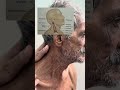 Cervical (neck) Lymph node examination