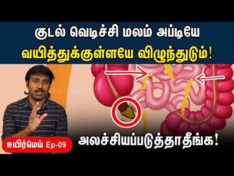 Appendix | Appendicitis Explained In Tamil | Uyirmei Ep - 09