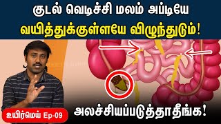 யாருக்கெல்லாம் appendix பிரச்சனை வரும்? | Appendicitis explained in Tamil | Uyirmei EP - 09 screenshot 4