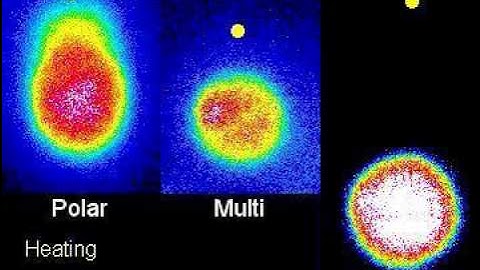 Local Heating Changes Intracellular Ca2+ Levels