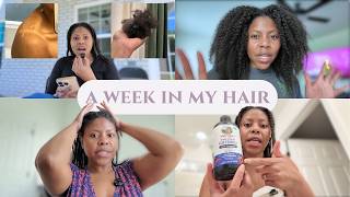 wait… can scalp sunburn cause hair loss? |Twist Out, Ivy Braids thoughts & MORE [40]