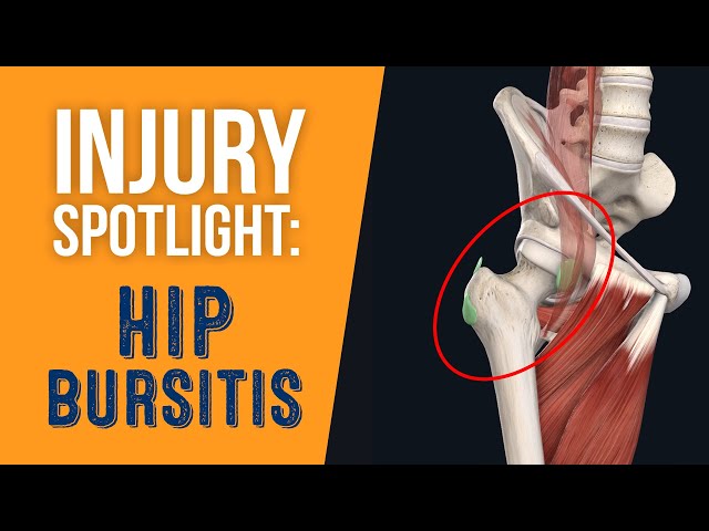 Hip Bursitis Diagnosis