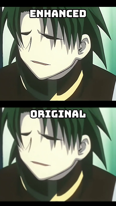 😂 Killua Every Time Said