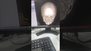 vrt editing ge machin pr #brainctscan