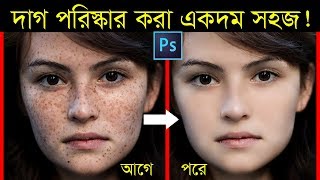 How to Quickly Smooth Skin and Remove Dark Spots, Blemishes & Scars (Easily): Photoshop Tutorial screenshot 2