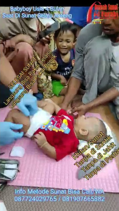 Spesialis Sunat Bayi