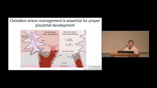 Dr. Solmonson's Presentation