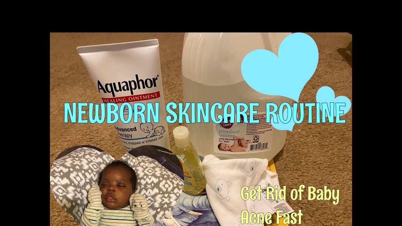 HOW TO GET RID OF BABY ACNE | Newborn Skincare Routine🧼