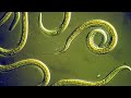 Nematodes: Characteristics and Impact