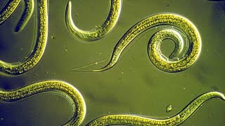 Phylum Nematoda Part 1: Introduction to the Roundworms