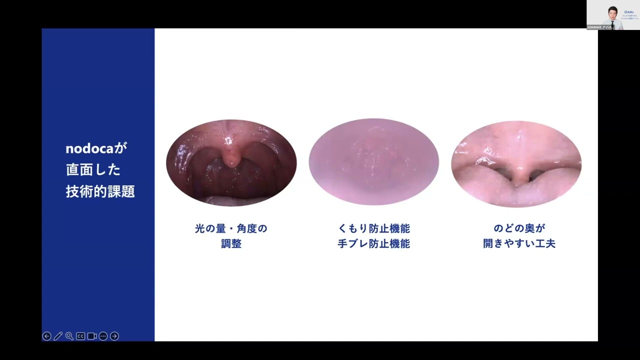 感染症判定AI咽頭カメラ, image size:1280x720