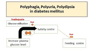 Súlycsökkenés polyphagia polydipsia