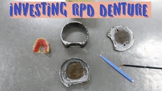 Removable Partial Denture processing