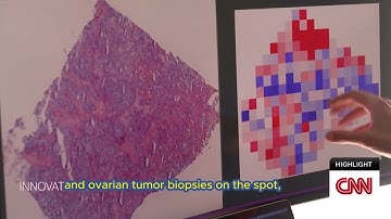 Professor of Medicine Ludmil Alexandrov, Ph.D. Developed AI Tool Identifying Breast/Ovarian Cancers