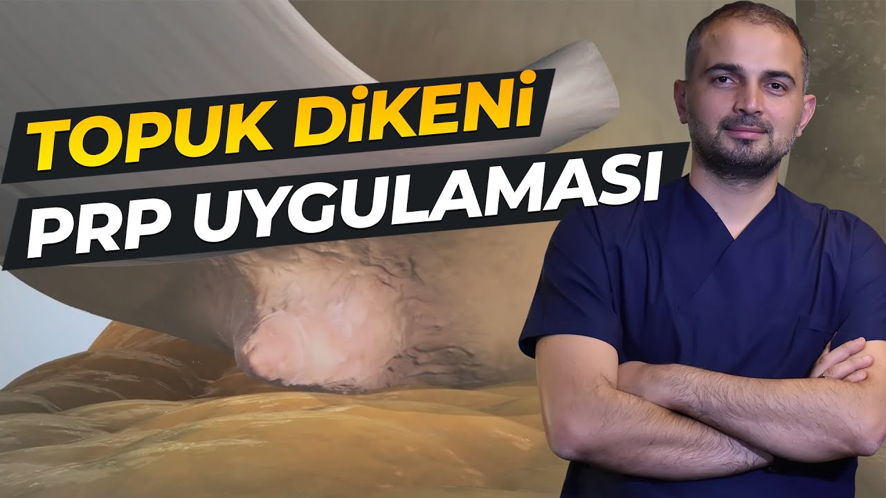 TOPUK DİKENİ TEDAVİSİNDE PRP UYGULAMASI (Ortopedi)