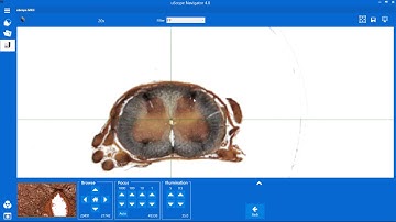 Browsing a Slide with the uScope Digital Microscope