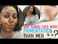 Why Female Faces More Pigmentation than Men | Pigmentation Treatment on Face at Home | Natural DIY