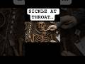 Why Were People Buried With Sickles on Their Throats?