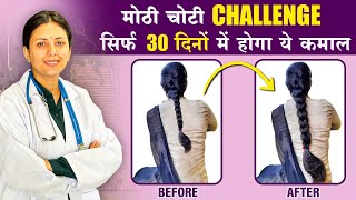 30 Days Challenge | इस उपाय से, बालों को मिलेगी दोगुनी तेजी से उगने की शक्ति❤️ | Upasana Ki Duniya