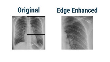 Image Filters (Smoothing Filter, Edge Enhancement Filters)